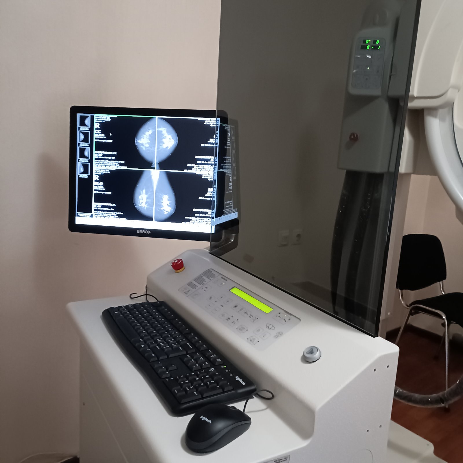 МЛ5 мамограф 3