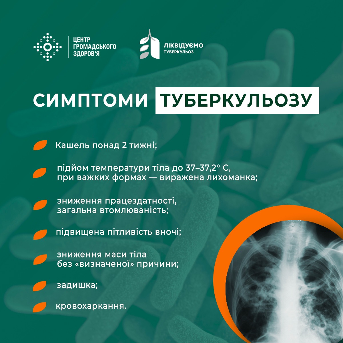 Смптоми туберкульозу